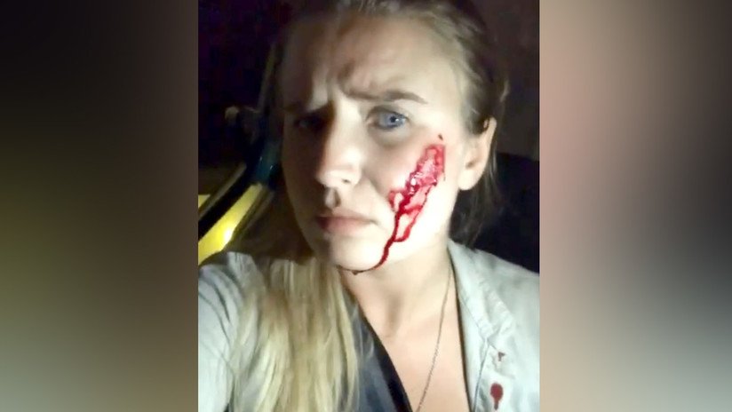 Una activista vegana libera 16 conejos y los granjeros disparan contra su auto (VIDEO)