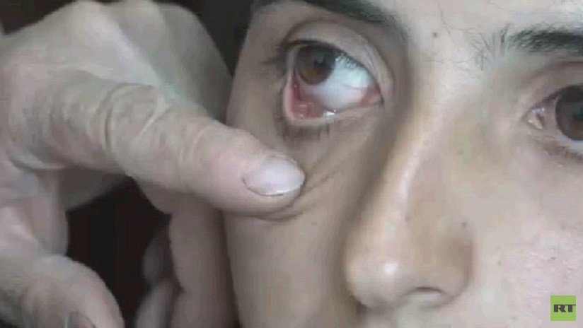 Desmienten la historia de la joven armenia que afirma llorar cristales