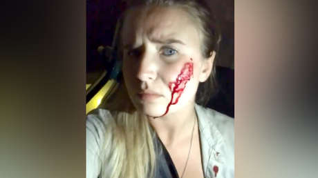 Una activista vegana libera 16 conejos y los granjeros disparan contra su auto (VIDEO)