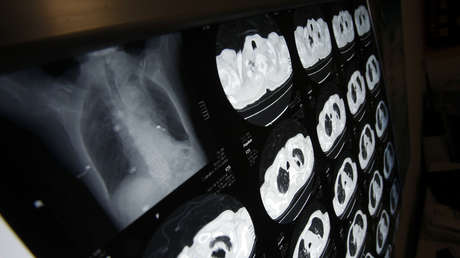 Un fallo inédito en Argentina obliga a una tabacalera a indemnizar a la familia de un fumador que murió a causa del cigarro