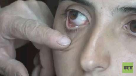 Desmienten la historia de la joven armenia que afirma llorar cristales