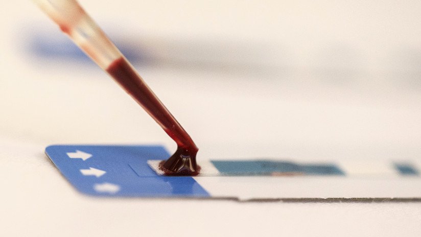 Identifican una nueva cepa del VIH por primera vez en casi dos décadas