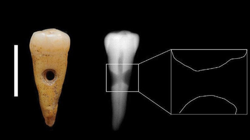 Hallan joyas hechas de dientes humanos en un antiguo asentamiento en Turquía