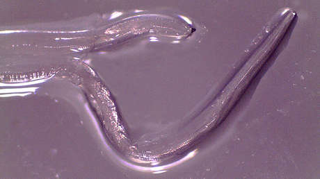 Una mujer es la segunda paciente en tener gusanos parasitarios en un ojo y no será el último caso