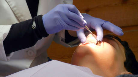 Un hombre descubre que le creció un diente durante 20 años en la nariz