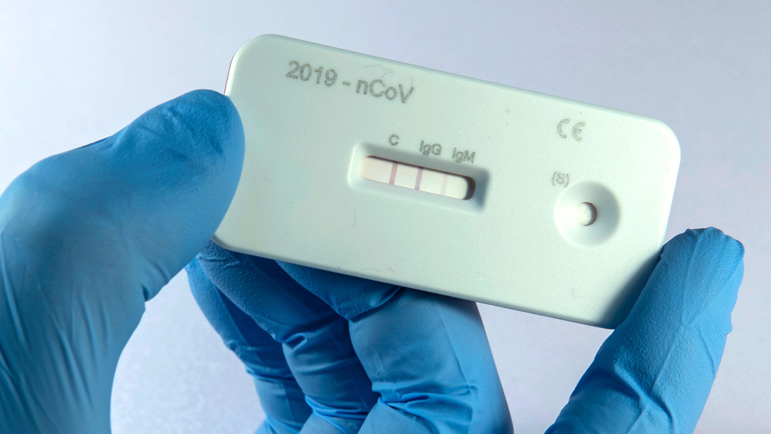 Expertos esperan que los test de anticuerpos permitan saber hasta cuándo es necesaria la cuarentena por coronavirus