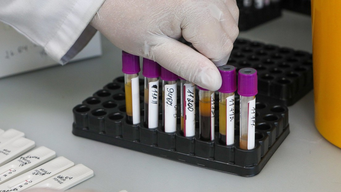 "En ningún caso hay que automedicarse": un destacado científico ruso afirma que más del 50 % de los infectados con covid-19 pueden no tener síntomas