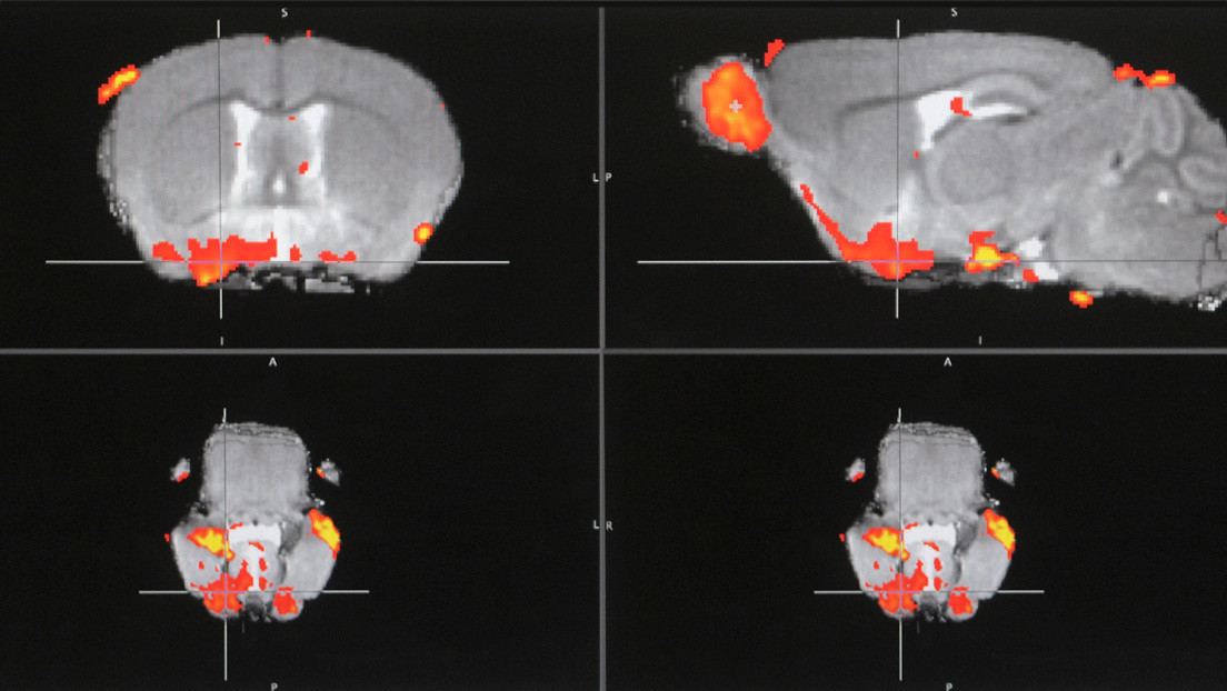 Descubren un 'interruptor' del dolor en el cerebro que abre el camino a una nueva clase de analgésicos
