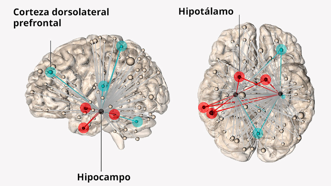 Científicos localizan dónde radica el estrés en el cerebro humano