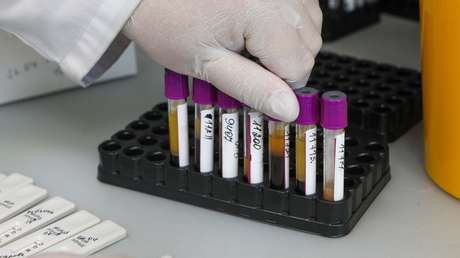 "En ningún caso hay que automedicarse": un destacado científico ruso afirma que más del 50 % de los infectados con covid-19 pueden no tener síntomas