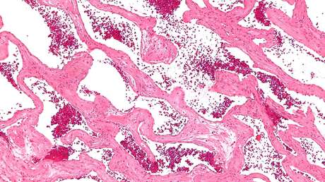 Aseguran que el microbioma intestinal humano puede afectar gravemente procesos neurológicos