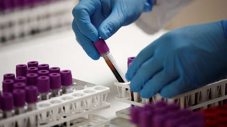 Científicos explican por qué las personas con grupo sanguíneo A son más susceptibles a la insuficiencia respiratoria causada por el covid-19