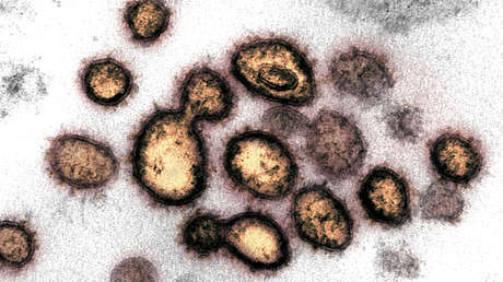 Científicos sospechan que el covid-19 podría provocar diabetes