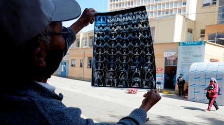 El número de muertes por coronavirus supera las 476.000 personas a nivel mundial