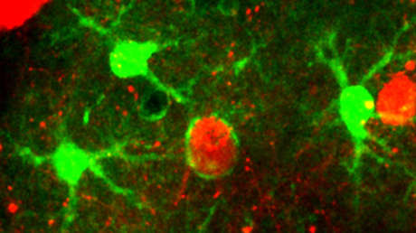VIDEO: Filman por primera vez cómo el cerebro se deshace de las neuronas muertas