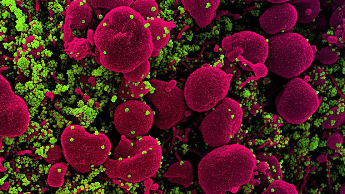 Prueban con éxito un fármaco capaz de reducir "considerablemente" el riesgo de desarrollar cuadros severos de coronavirus