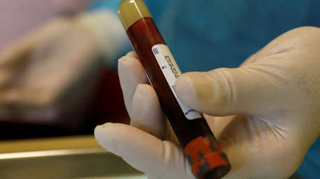 El nuevo hallazgo sobre cómo el coronavirus afecta a la sangre "agrega una pieza importante al rompecabezas del covid-19"