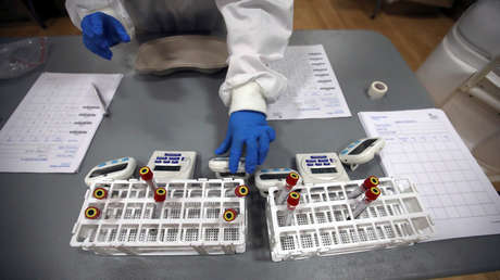 Autopsias de pacientes con covid-19 muestran coágulos de sangre en distintos órganos