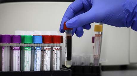 Hospitales de Moscú reúnen más de una tonelada de plasma con anticuerpos para tratar a pacientes con covid-19