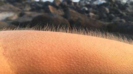 Descubren para qué se nos pone la piel de gallina