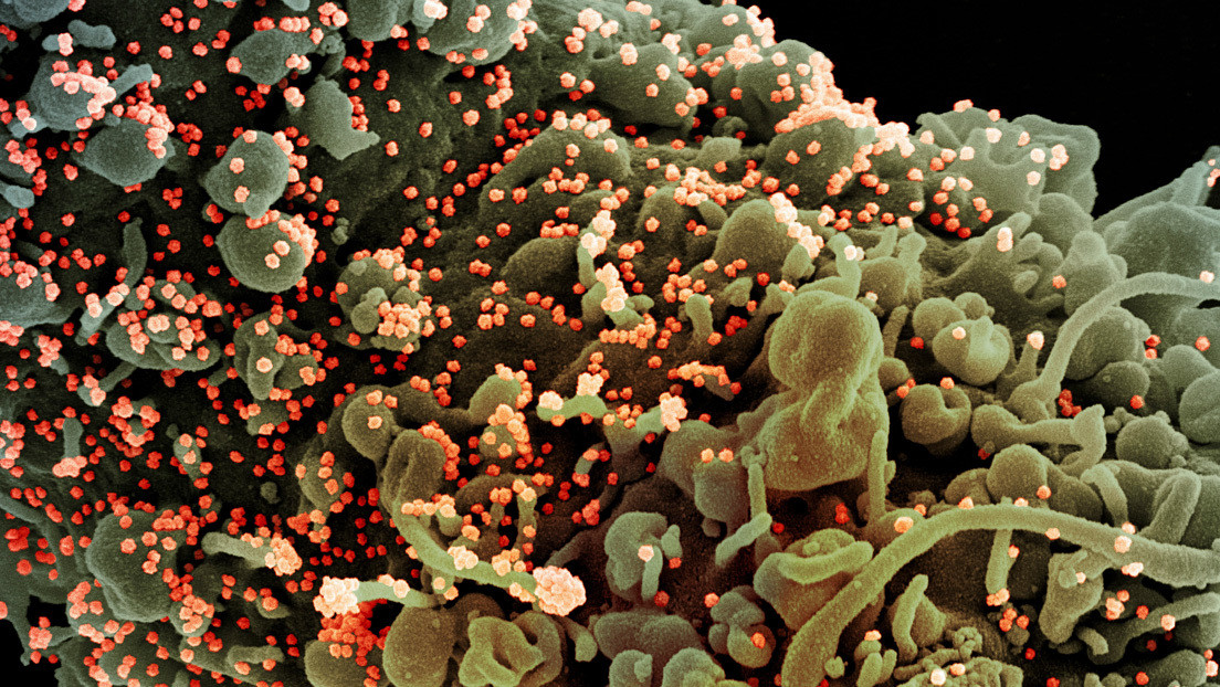 "Sus espigas son muy flexibles": Un estudio sobre el coronavirus arroja luz sobre su forma de entrar en las células