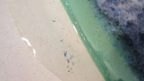 Científicos detectan microplásticos en órganos humanos y temen que podrían aumentar el riesgo de infertilidad y cáncer