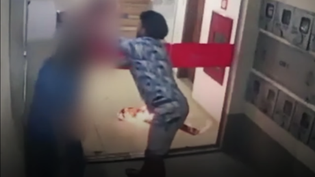 Una modelo brasileña queda envuelta en llamas y sufre quemaduras en casi la mitad de su cuerpo