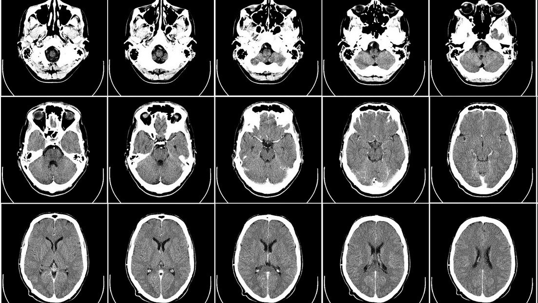 Un aficionado a la jardinería contrae de la tierra de una maceta una infección mortal que le 'disolvió' el cerebro
