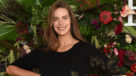 FOTOS: Una modelo revela en Instagram las lesiones que una enfermedad deja en su cara