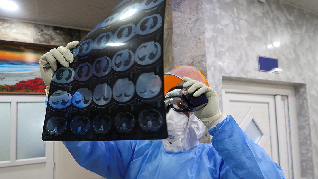 Inmunidad incierta: Un estadounidense que superó el covid-19 se contagió por segunda vez de forma más grave