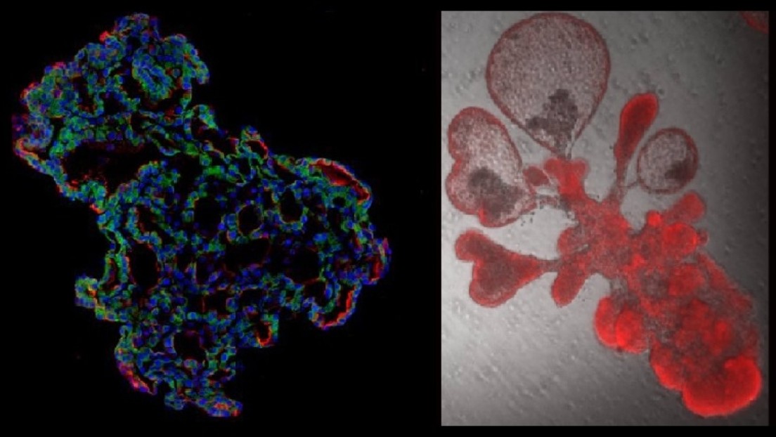 'Minipulmones' cultivados en laboratorio permiten a científicos observar cómo el coronavirus infecta los alvéolos y hallar soluciones más eficientes