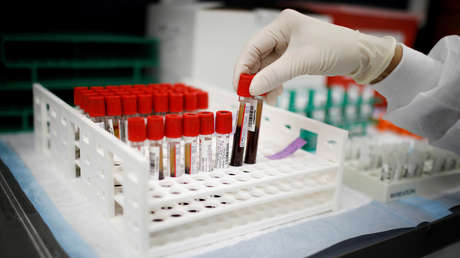 Los anticuerpos de covid-19 en el plasma sanguíneo de donantes disminuyen rápidamente después de los primeros síntomas