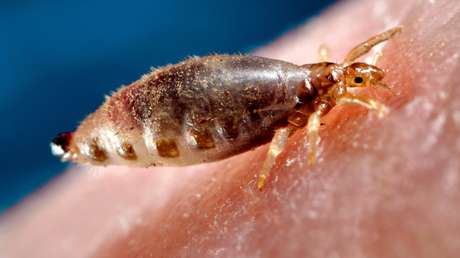 Niña de 12 años muere por una infestación de piojos y acusan a sus padres de homicidio