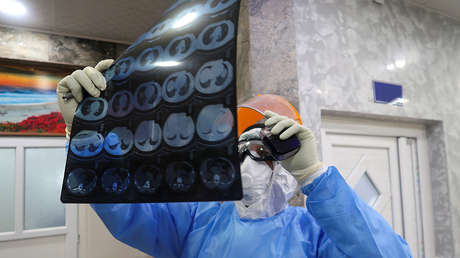 Inmunidad incierta: Un estadounidense que superó el covid-19 se contagió por segunda vez de forma más grave