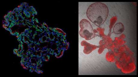 'Minipulmones' cultivados en laboratorio permiten a científicos observar cómo el coronavirus infecta los alvéolos y hallar soluciones más eficientes