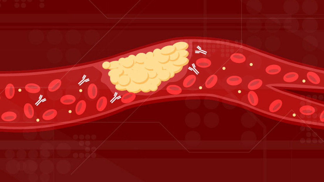 Científicos hallan por qué se forman coágulos de sangre potencialmente mortales en pacientes con covid-19