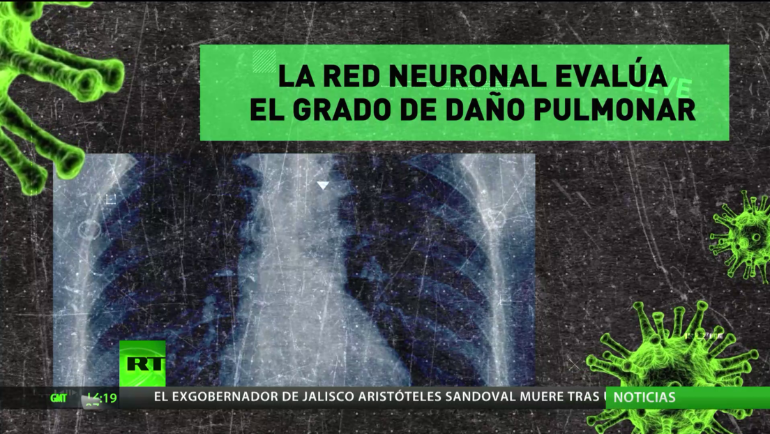 Rusia: Desarrollan una calculadora de tomografía computarizada para evaluar el daño pulmonar