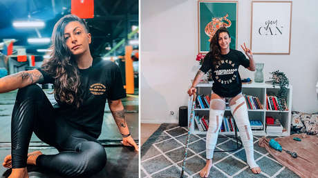 Luchadora de MMA sufre terribles quemaduras y queda a punto de perder sus piernas tras una fallida sesión de crioterapia