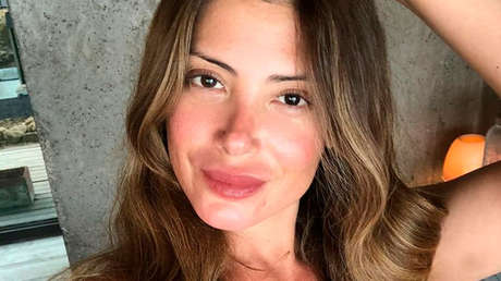 Imponen una multa de 27.000 dólares a una modelo chilena por "engañar al público" al promover un ayuno de 21 días