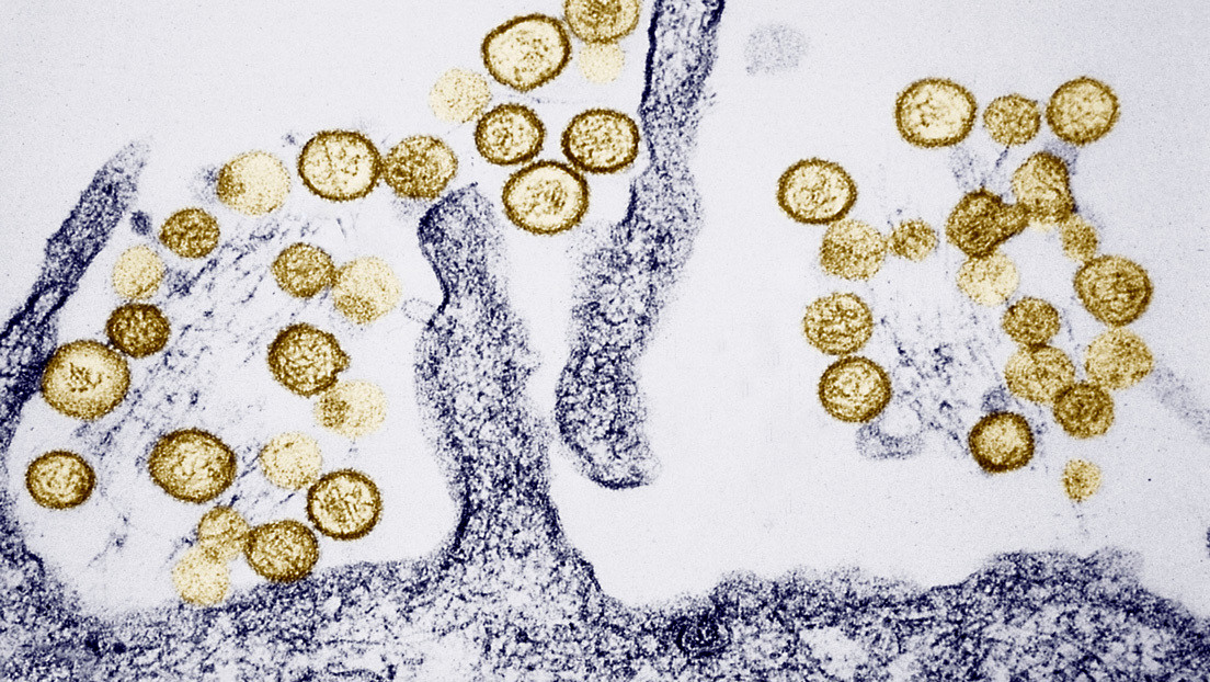 Muere un joven por hantavirus en Argentina y temen que aumenten los casos: "Es endémico"