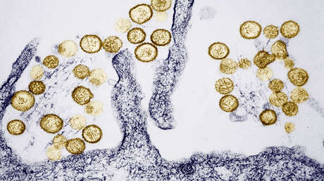 Muere un joven por hantavirus en Argentina y temen que aumenten los casos: "Es endémico"