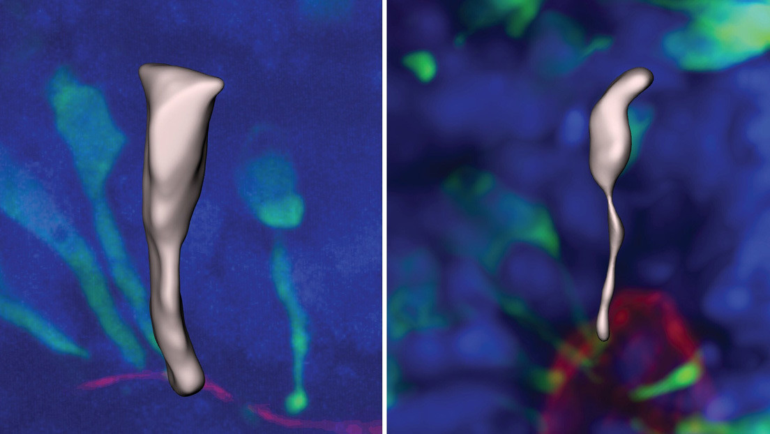 Establecen cómo el desarrollo temprano del cerebro distingue a los humanos de los simios
