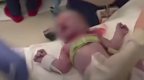 Científicos graban los pulmones de recién nacidos durante su primera respiración (VIDEO)