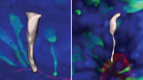 Establecen cómo el desarrollo temprano del cerebro distingue a los humanos de los simios