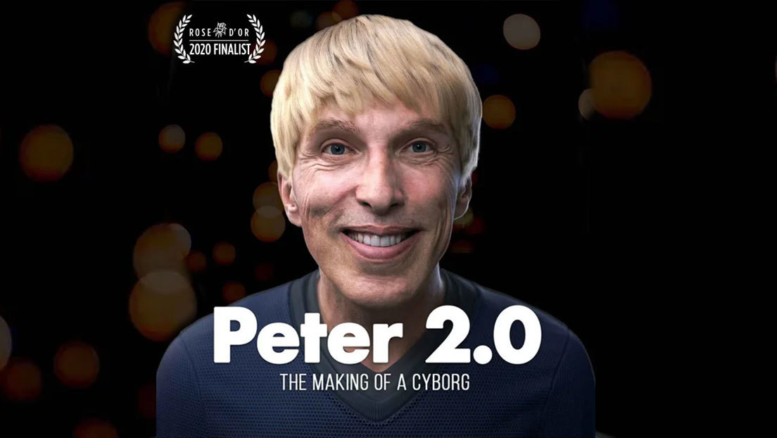 El científico que se convirtió en el primer cíborg del mundo por una enfermedad mortal afirma que lleva una vida "excepcional"