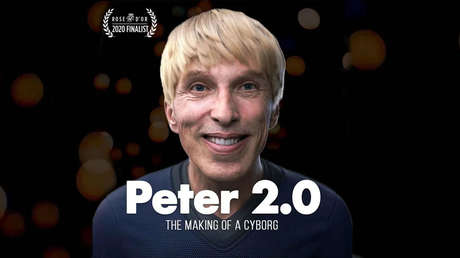 El científico que se convirtió en el primer cíborg del mundo por una enfermedad mortal afirma que lleva una vida "excepcional"