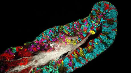 Científico advierte de una "profunda ignorancia" sobre la diversidad de los microbios