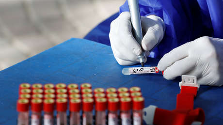 Crean una prueba para predecir si un enfermo de covid-19 desarrollará síntomas graves