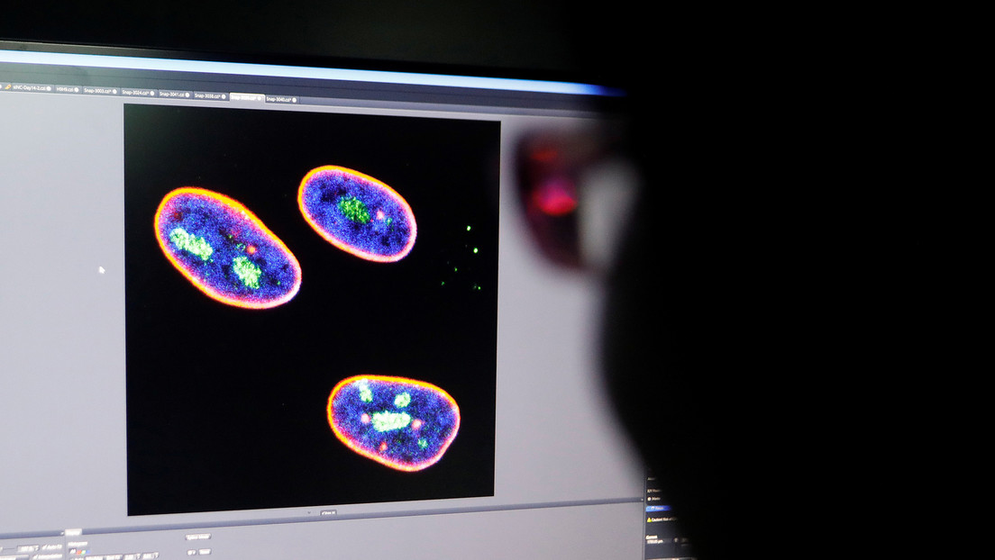 Cobre y hierro en el cerebro: ¿serán la causa del Alzheimer?