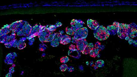 Muestran en ratones la efectividad de un implante capaz de normalizar la secreción de insulina en pacientes con diabetes tipo 1